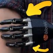 un orthopédiste en allemagne a créé, grâce au scan 3D, un bras bionique contrôlé par la pensée