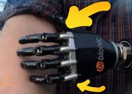 un orthopédiste en allemagne a créé, grâce au scan 3D, un bras bionique contrôlé par la pensée
